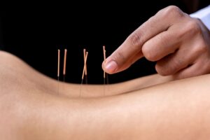 acupuncture for chronic low back pain winnipeg