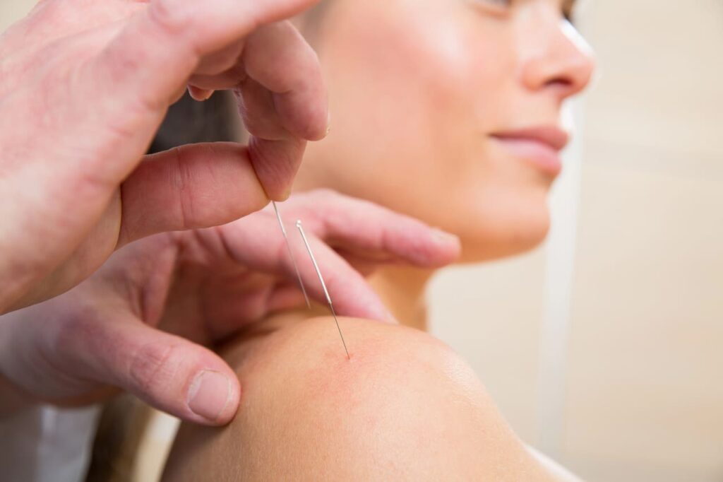 acupuncture for neck and shoulder pain winnipeg