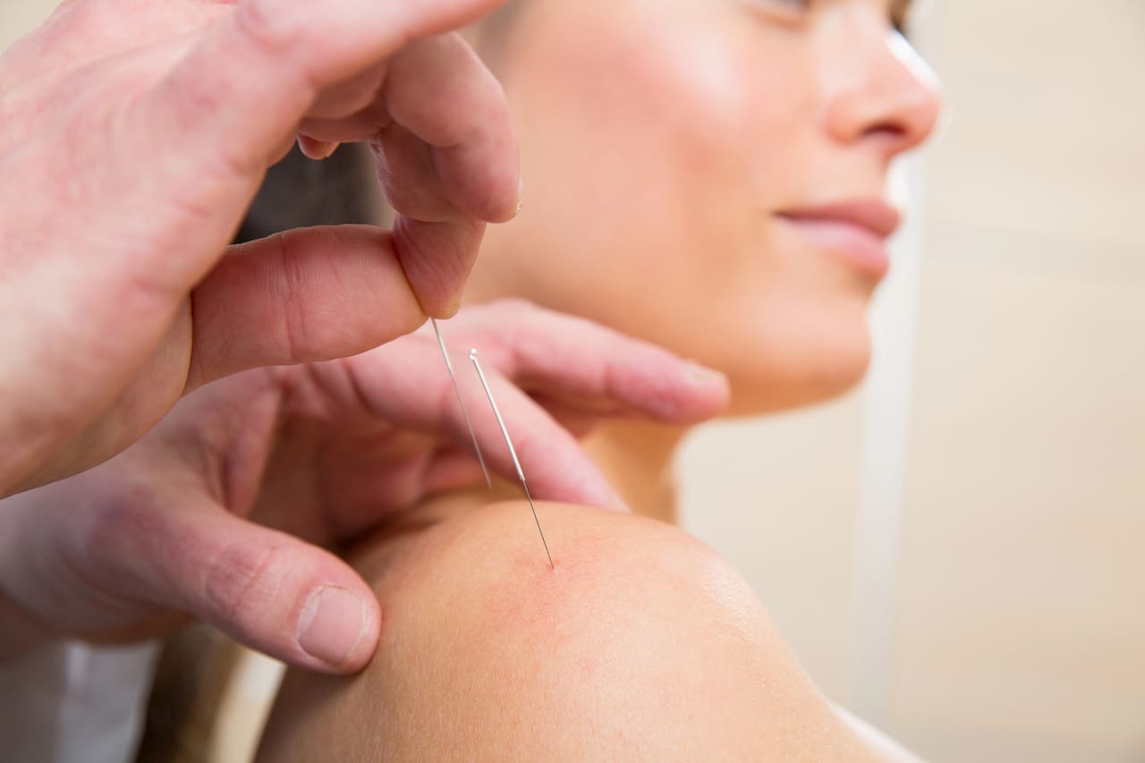 acupuncture for neck and shoulder pain winnipeg